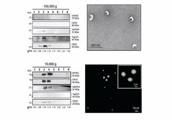 Exosome：为肿瘤临床诊断和治疗带来新的契机