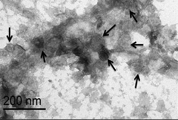 外泌体临床样品检测文献8篇