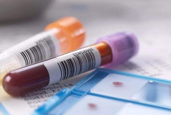 Exosome：临床样本研究实验设计和正常对照